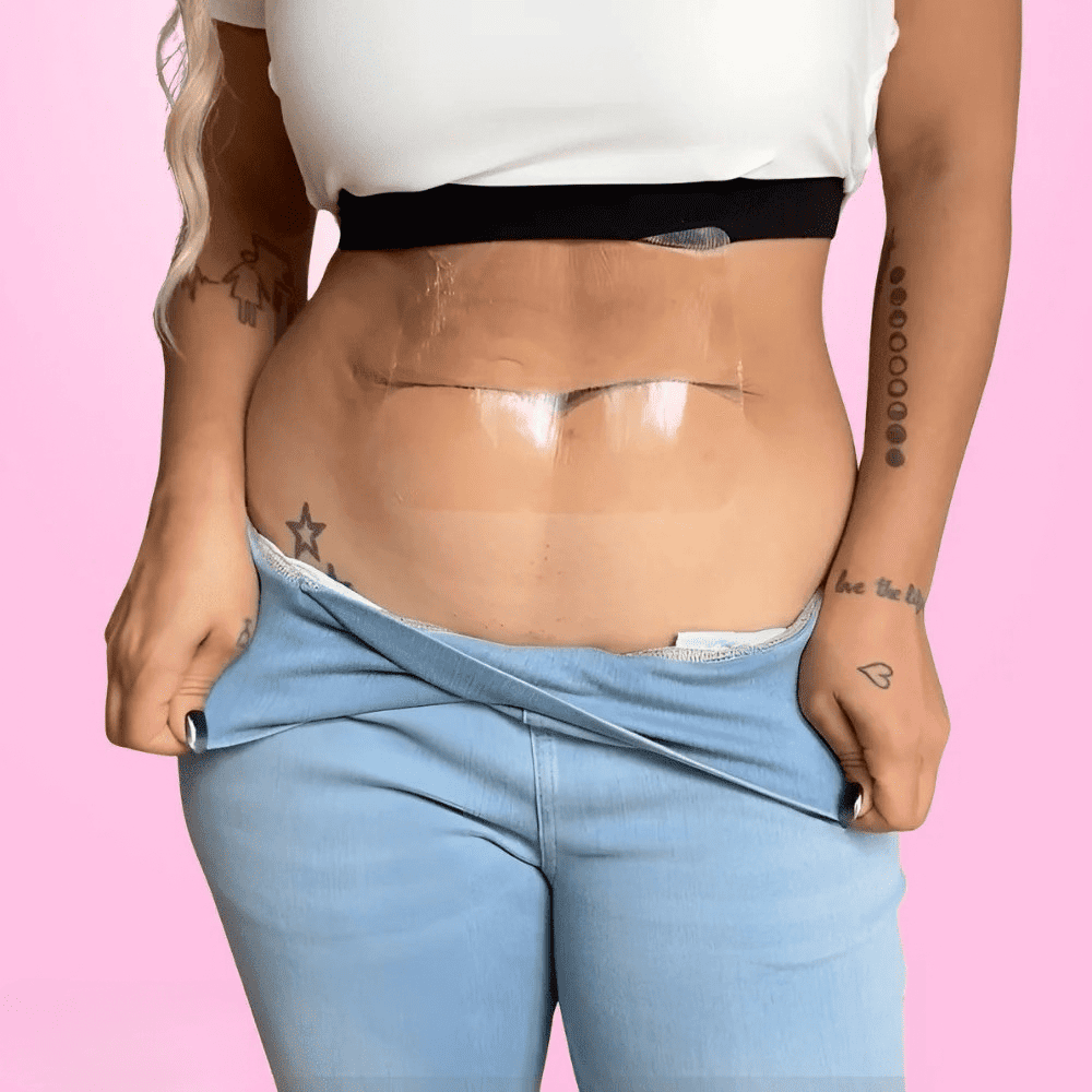 SnowBloom™ Tummy Lifting Tapes ( 10 Tapes )