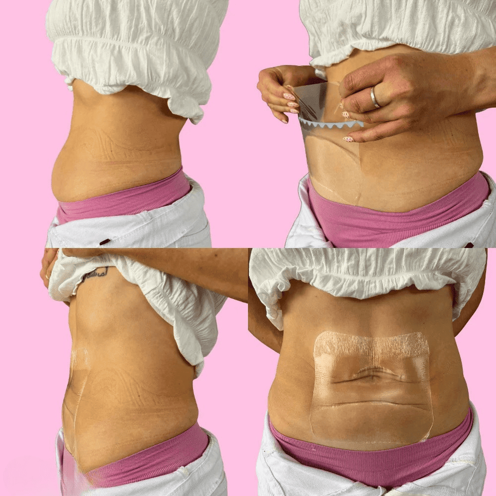 SnowBloom™ Tummy Lifting Tapes ( 10 Tapes )