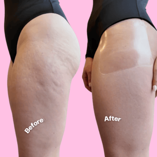 SnowBloom™ Thigh and Booty Lifting Tapes ( 10 Tapes )